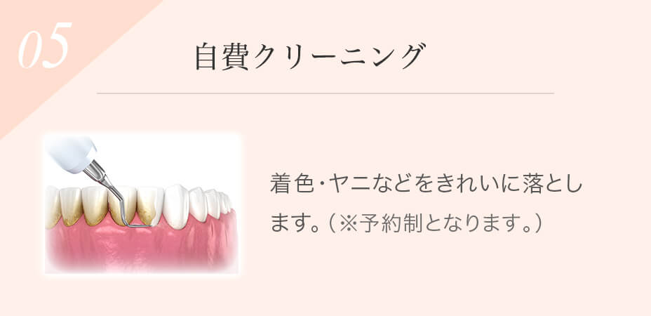 自費クリーニング