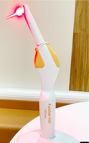 PDT(光殺菌治療器)