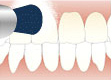 歯のクリーニング 自宅での使用方法の説明