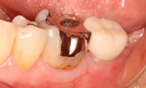 平田12 上部構造装着
