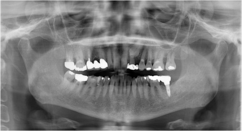平田13 上部構造装着時