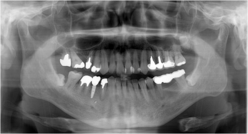 張9 上部構造装着後パノラマ撮影