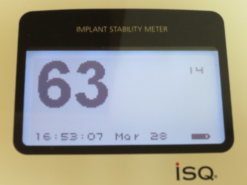 松本9 2次オペ時ISQ値