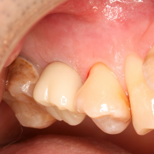 田村9 同上部構造装着