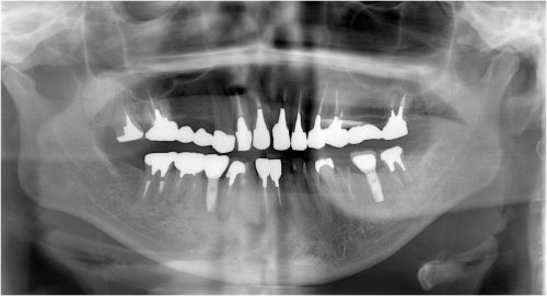 %e7%9f%b3%e5%b7%9d10-%e5%8f%b3%e4%b8%8b5-%e4%b8%8a%e9%83%a8%e6%a7%8b%e9%80%a0%e8%a3%85%e7%9d%80%e5%be%8c