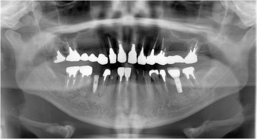 %e7%9f%b3%e5%b7%9d9-%e5%8f%b3%e4%b8%8b5-%e5%9f%8b%e5%85%a5%e5%be%8c%e3%83%91%e3%83%8e%e3%83%a9%e3%83%9e%e5%83%8f