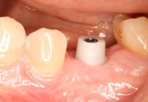 阿久井8 土台装着