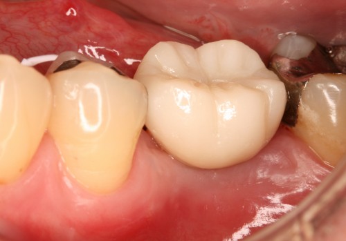 青木9 上部構造装着時